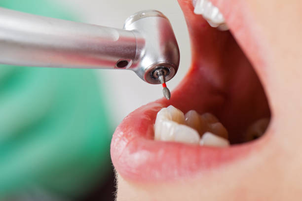Best Weekend Emergency Dentist in Vanceburg, KY